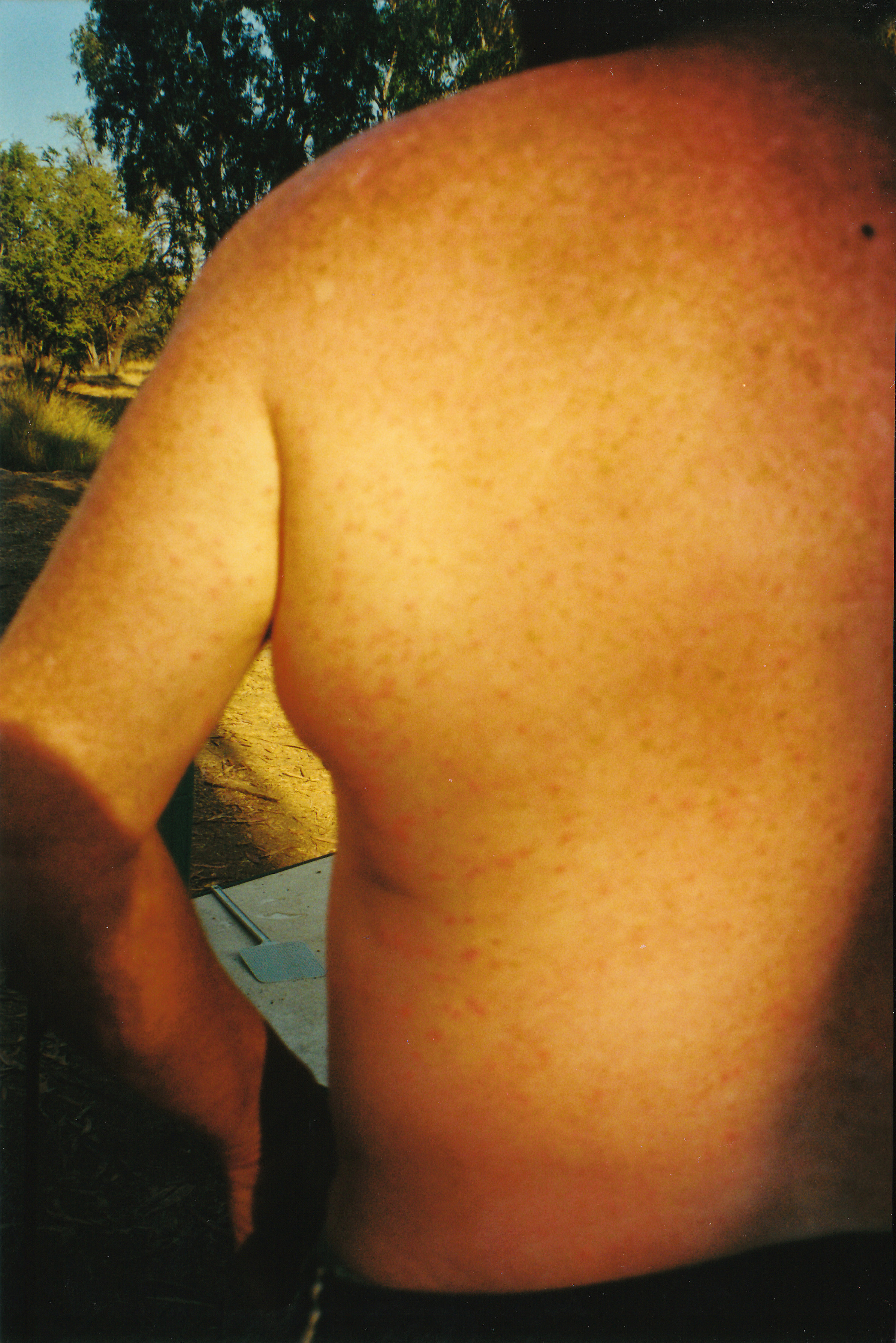 08-11-2000 03 kimberley rash.jpg